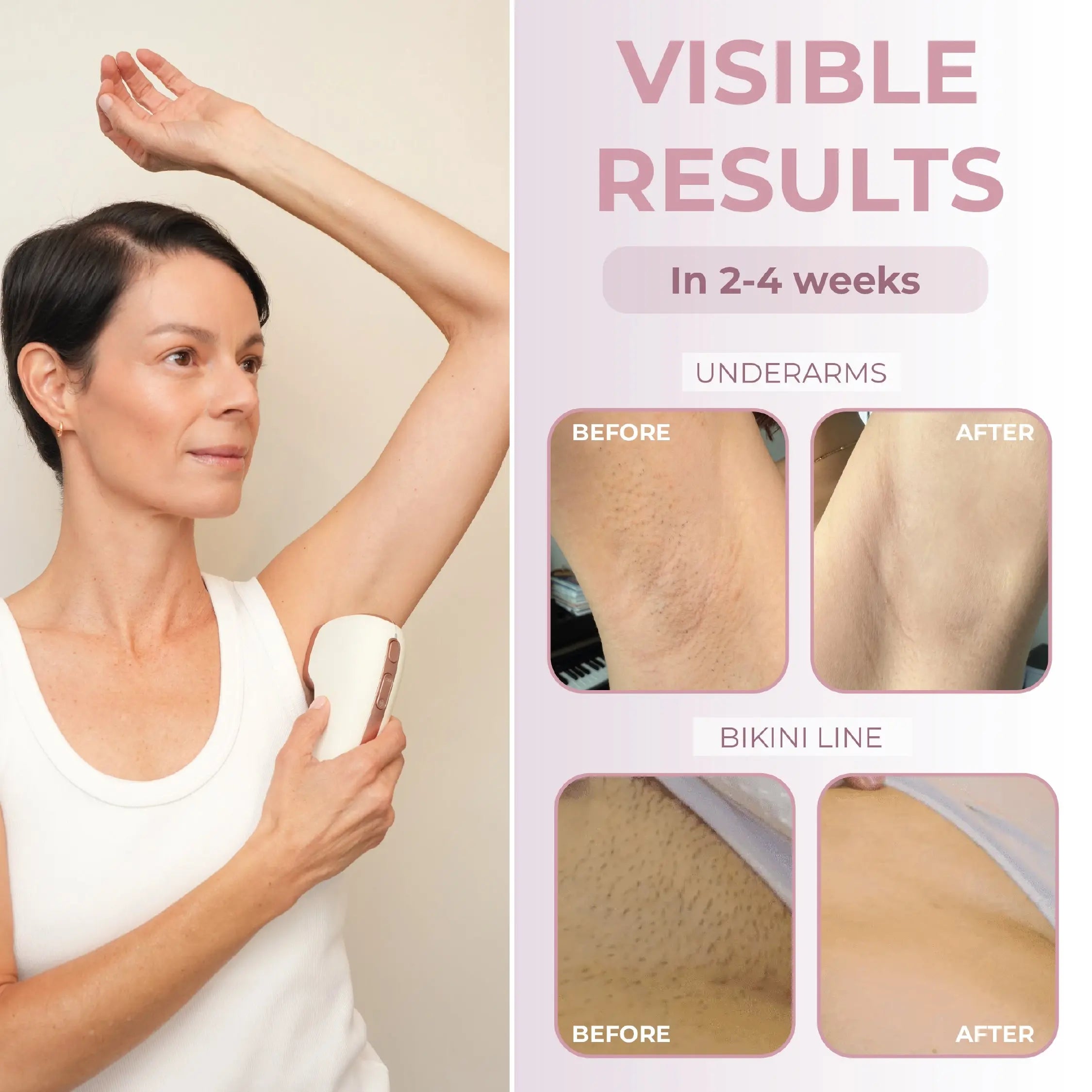 RIKI SILKY Hand-Held IPL Hair Removal Device RIKI LOVES RIKI