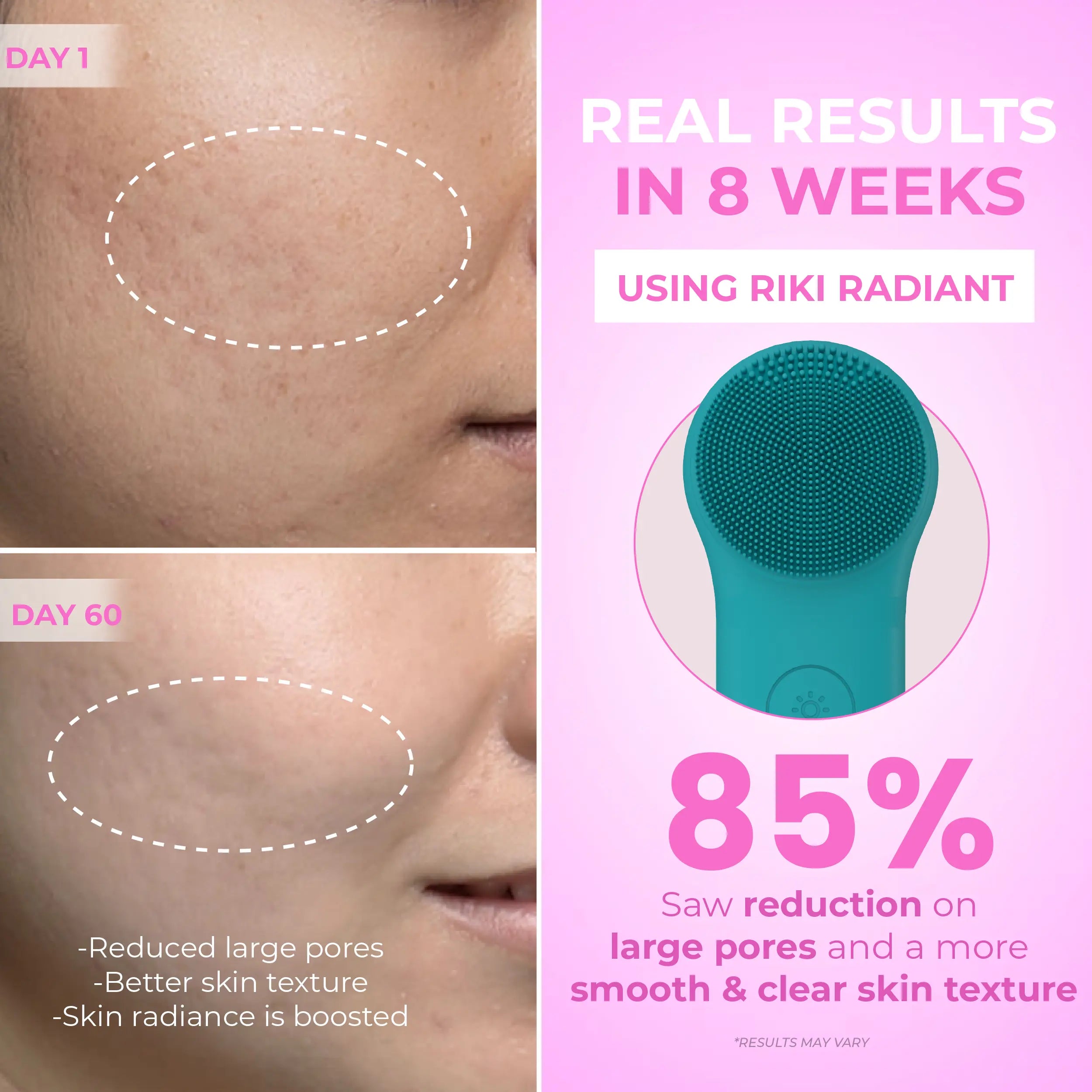 RIKI RADIANT Dual-sided Silicone Face Cleansing System RIKI LOVES RIKI