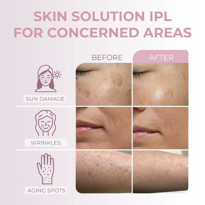 RIKI SILKY Hand-Held IPL Hair Removal Device RIKI LOVES RIKI